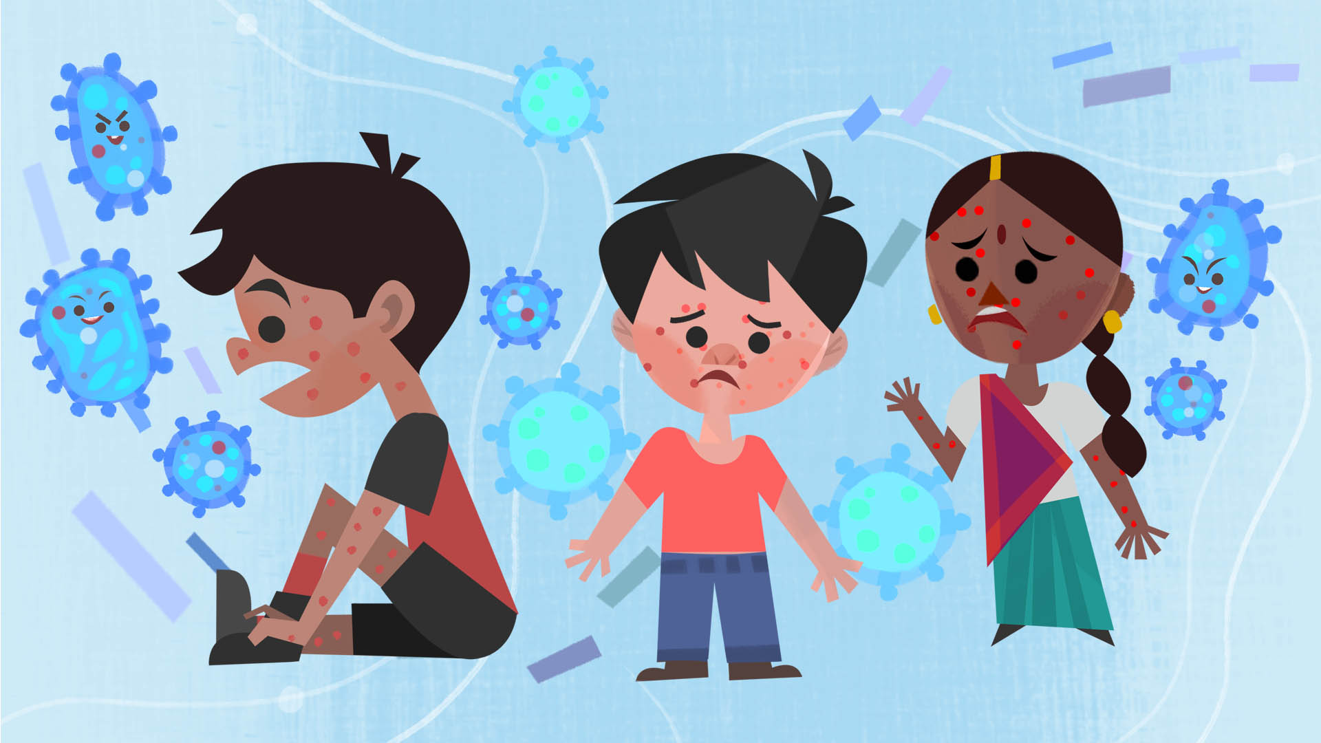 is measles similar to mumps or rubella