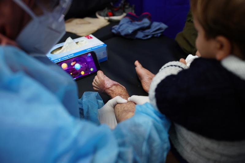 Palestine: Burn injuries, a chronic health problem in Gaza