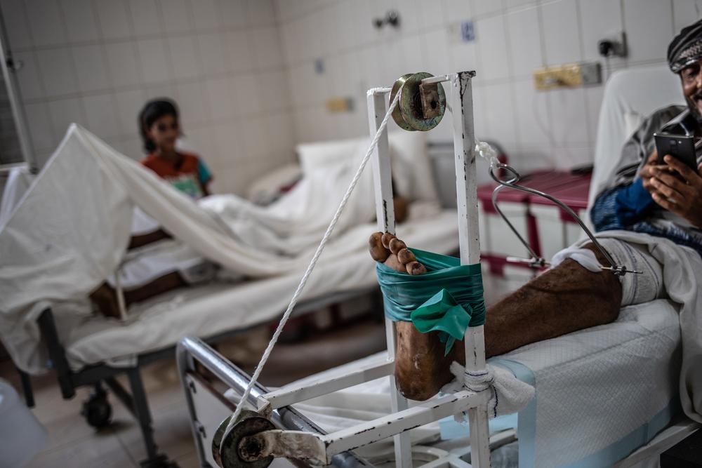 Abdallah in the IPD of MSF trauma hospital in Aden, after his referral from Mocha MSF surgical hospital