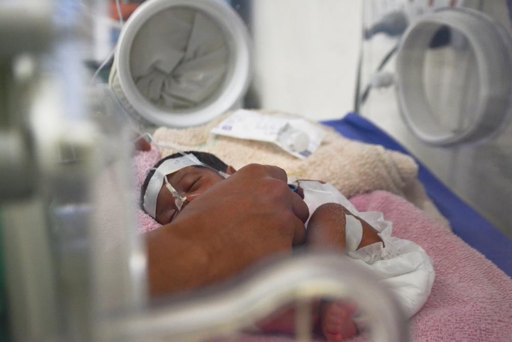 This premature baby was born, it weighed only 1.2 kg. He had difficulty breathing and suffered from lethargy because it was a premature birth.