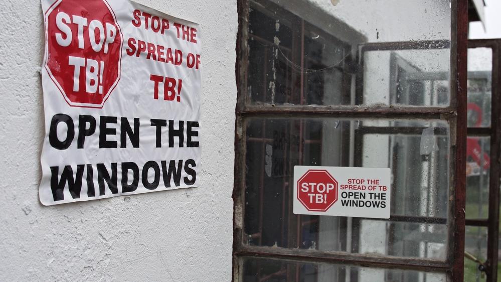 Everybody Breathes: Treating TB in Eshowe, South Africa