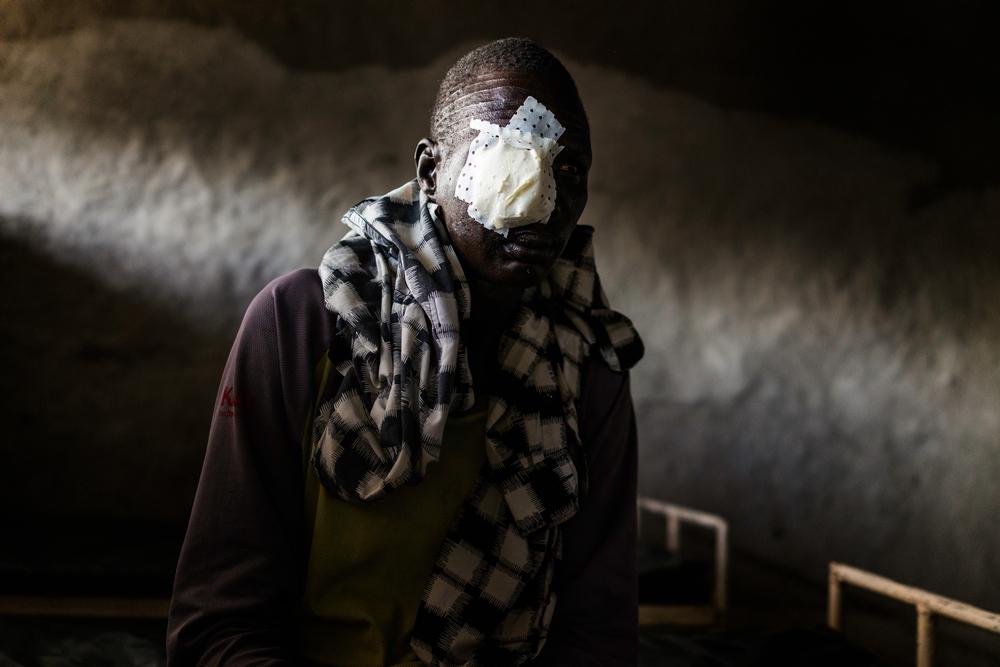 Peter Gatlek (50) sits on a hospital bed after receiving new bandages at the hospital in Lankien. South Sudan, 2015