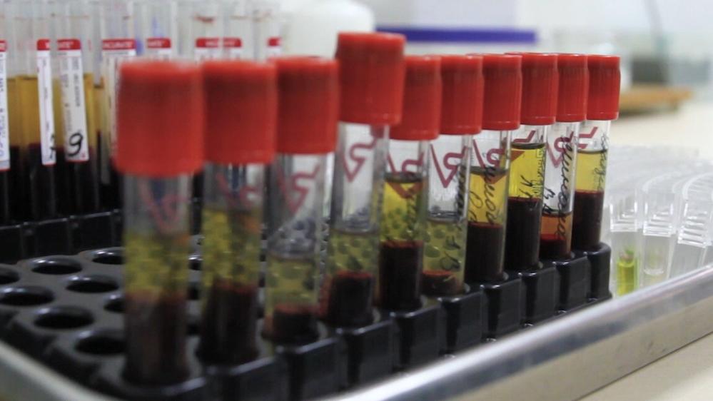 Hepatitis C in Ukraine, 2019