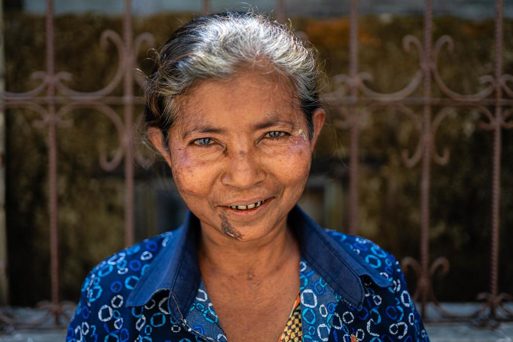 Daw Than Than receives mental healthcare services at MSF’s clinic in the Aung Mingalar ghetto in downtown Sittwe in Rakhine state.