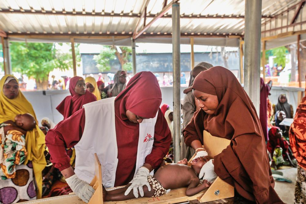 A child is being checked by an MSF staff at Kofar Marusa ATFC Nigeria. © George Osodi