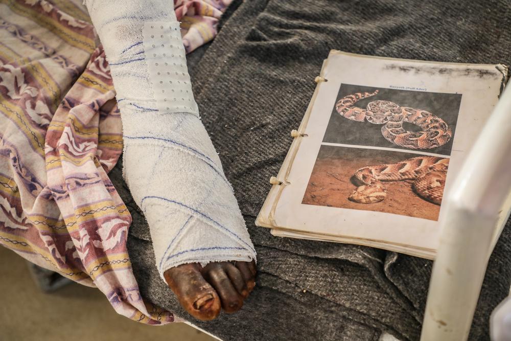 an MSF patient's foot next to picture of venomous snake in South Sudan. © Fanny Hostettler