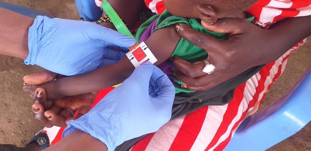 Doctors Without Borders nurse measuring the Mid-Upper Arm Circumference (MUAC) of a child in Elbet camp, Baidoa. Somalia, 2022. © MSF/Suleiman Hassan