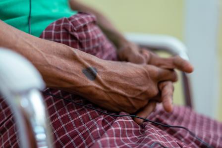 Doctors Without Borders: Ensure unimpeded access to healthcare in Myanmar