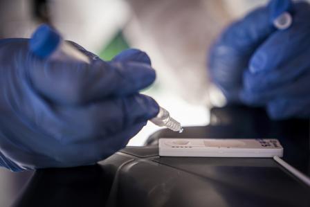 Press Release: COVID-19 shows need to boost production of medical diagnostic tools in Asia