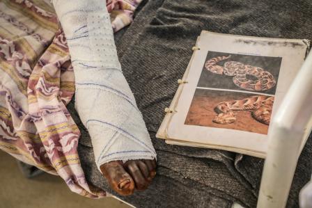 Why rapid treatment is essential after a snakebite: a story from South Sudan