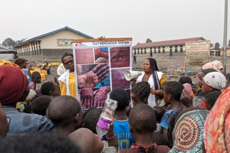 Mpox outbreak in DRC: 5 things to know 